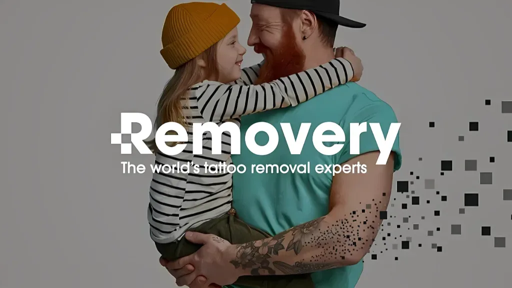 Removery Tattoo Removal & Fading — Tattoo removal service in Royal Oak